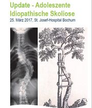 Skoliose
